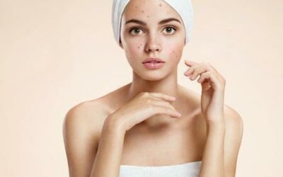 6 Beauty Concerns that Can Be Treated with IPL Skin Rejuvenation